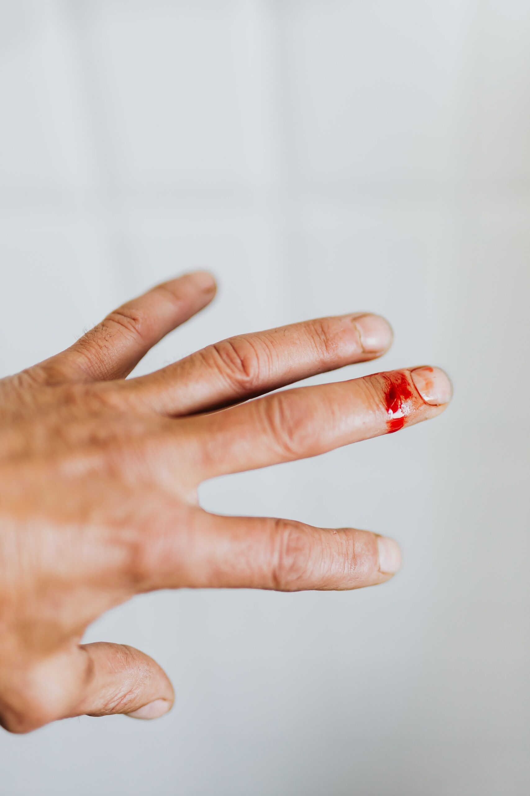 Come Fermare Il Sangue Da Un Taglio Di Lametta