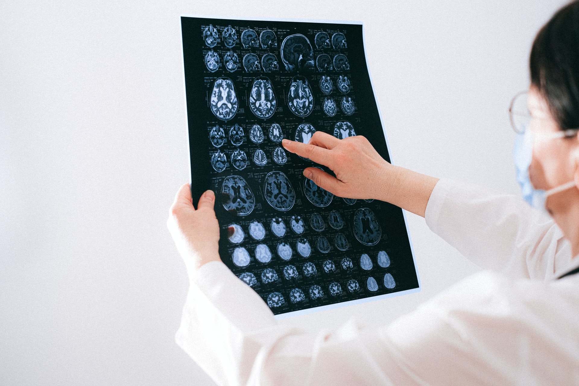 Esta vitamina sería la reina en la prevención del envejecimiento cerebral y sin ella el cerebro podría ralentizarse prematuramente
